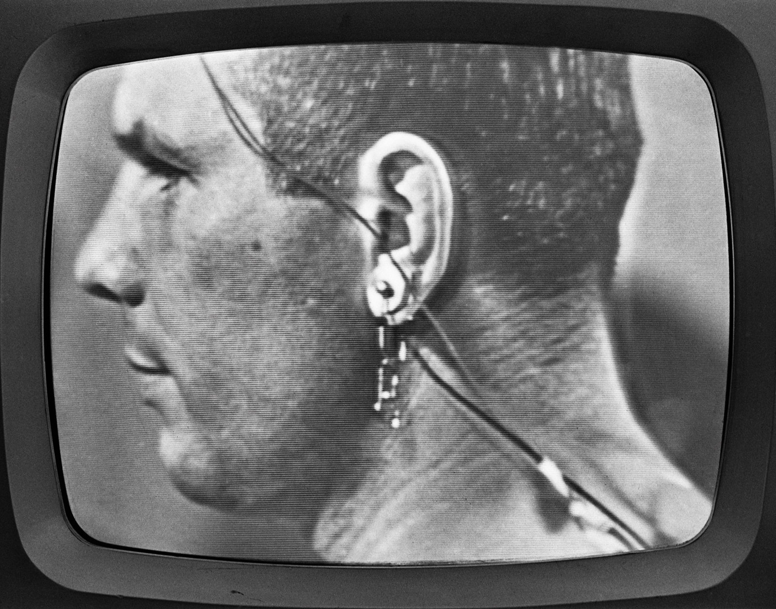 Czarno-białe zdjęcie wyświetlone na ekranie telewizora przedstawiające zbliżony profil mężczyzny od lewej, widoczną część twarzy i ucho z douszną słuchawką, kilkoma przewodami i drobnymi zawieszkami, z widocznymi poziomymi pasami skanowania i zaokrągloną ramką ekranu.