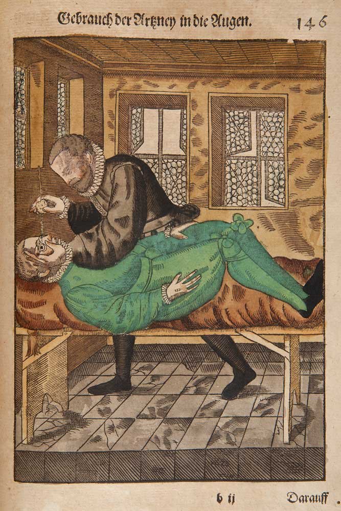 Kolorowana, historyczna ilustracja przedstawiająca mężczyznę w ciemnym ubraniu z fałdowanym kołnierzem pochylającego się nad leżącym na drewnianym stole mężczyzną w zielonym stroju i wkraplającego mu płyn do oka, we wnętrzu z dwoma zdobionymi oknami, wzorzystą posadzką oraz niemieckim nagłówkiem i numerem strony u góry.